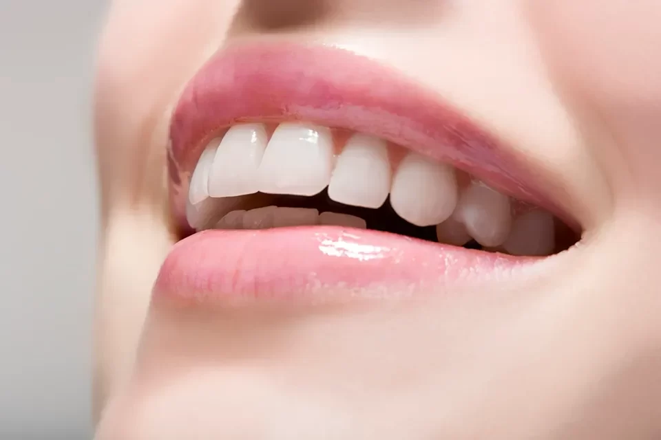 Understanding the Investment in Teeth Whitening Cost