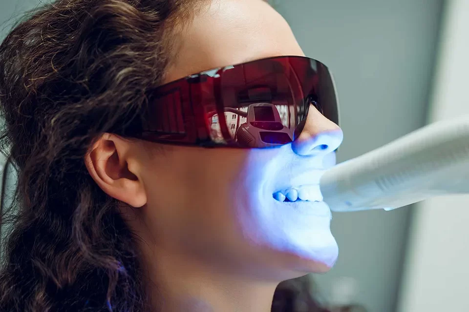 Is Teeth Whitening a Safe Procedure?