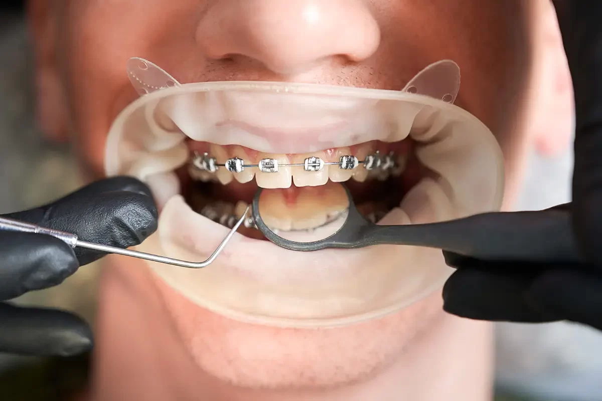 WP-Orthodontics-005